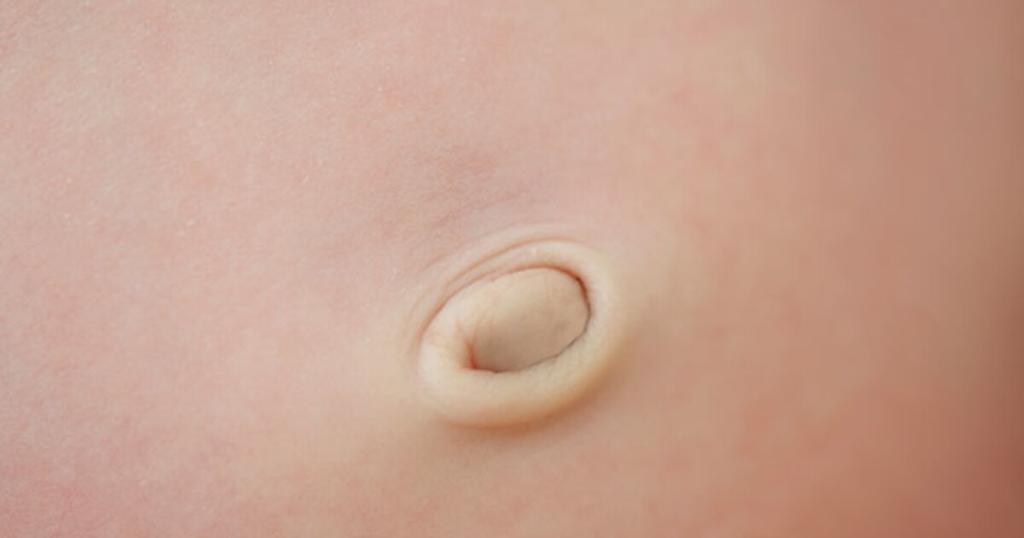 PHOTO-2023-03-09-11-13-24 15